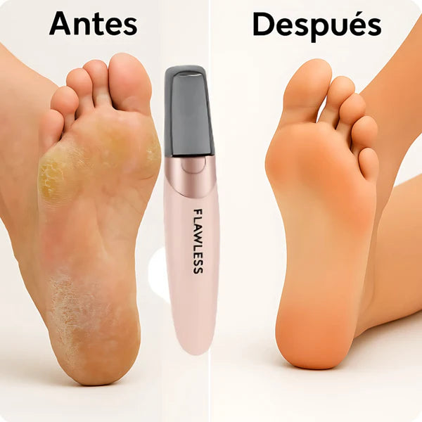 Eliminador de Callos Eléctrico Recargable - SOFTFEET PRO™